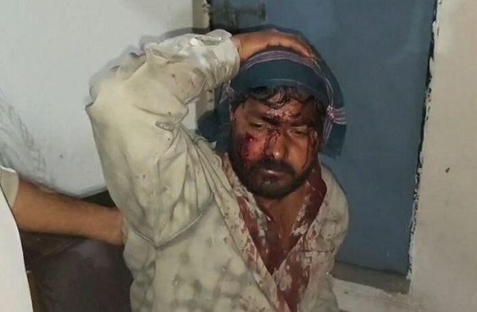 धारदार हथियारों से युवक पर जान लेवा हमला,हालत गंभीर